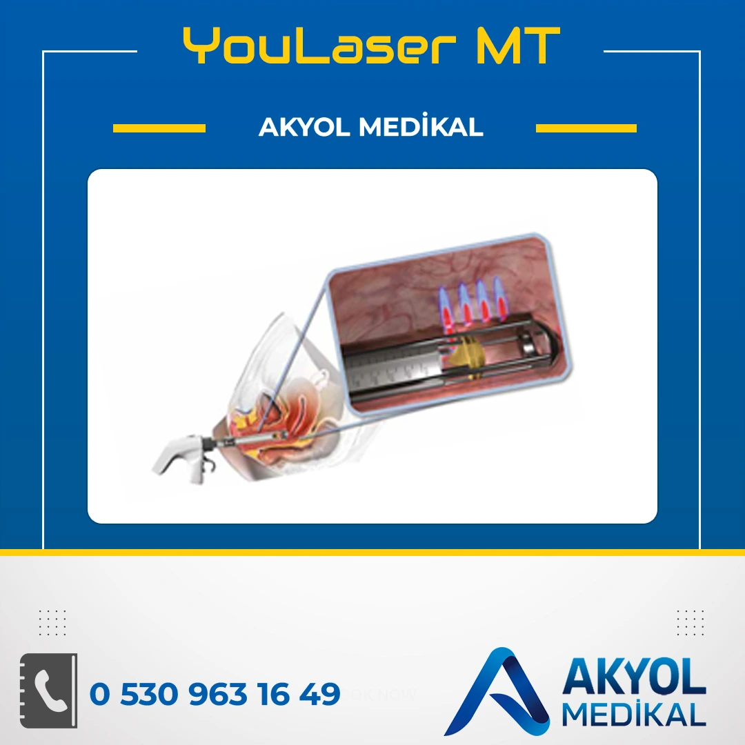 Youlaser MT